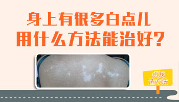 4個月孩子胳膊硬幣大白斑哪種方法安全，哪種副作用小