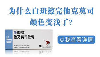 白癜風(fēng)初期能不能照美國308光