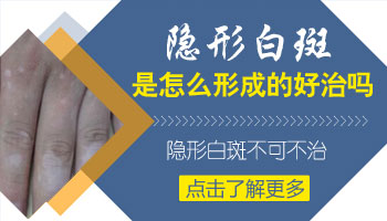 臉上長(zhǎng)早期白癜風(fēng)照308激光要多少錢(qián)