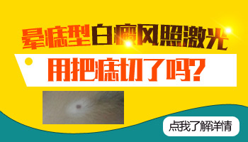 兒童后背有白塊照uvb一次要多少錢