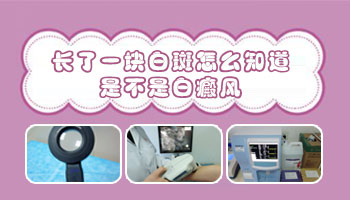 胸部白癜風有拳頭大照308激光一次多少錢