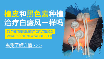 4個月孩子后背有白塊照308準分子激光多久能好