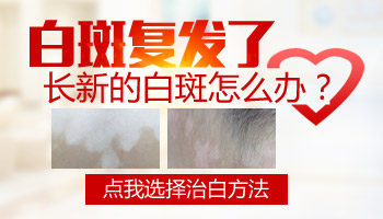 1歲孩子手臂黃豆大白斑用伍德燈能檢查出來嗎