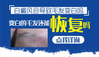 兒童胸部有白點在變大該怎么辦