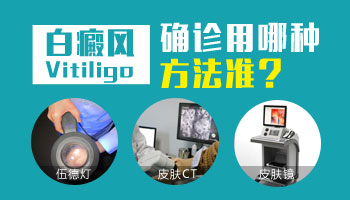 4個月孩子后背有塊白斑怎么形成的，白斑怎么治療