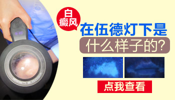 7個(gè)月孩子耳朵圓形白斑去醫(yī)院要做什么檢查