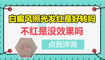 7個月孩子肩膀有白點照308nm激光多久能好轉