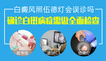 兒童面部巴掌大白塊進口308激光怎么治療