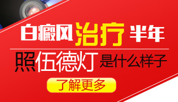 4個月孩子胳膊有白塊照wood燈顯熒光白是白癜風嗎