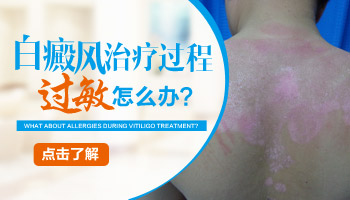 手指有白斑照308激光按什么收費