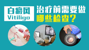 腿上長早期白癜風照308激光按什么收費