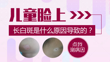4個(gè)月孩子腰部黃豆大白斑照wood燈顯熒光白是白癜風(fēng)嗎