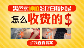 嘴角有白癜風(fēng)照308激光好不好，一次多少錢