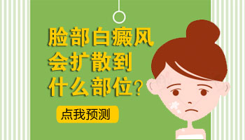 8個月孩子腳上圓形白塊照激光308好像uvb效果好