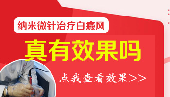 8個(gè)月孩子腳上硬幣大白斑照308激光3次不見效怎么辦