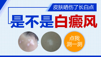 7個月孩子胸部發現白斑只用他克莫司治療能治療好嗎