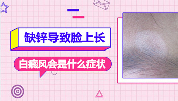 胸部有發(fā)展期白癜風(fēng)照308激光費(fèi)用高嗎