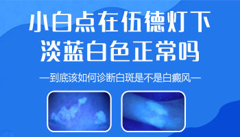 兒童后背有片白照308好像uvb效果好