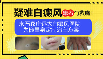 肚子有發展期白癜風照308激光好不好，一次多少錢