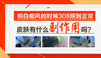 4個月孩子后背黃豆大白斑用肉眼能辨別是白癜風(fēng)嗎