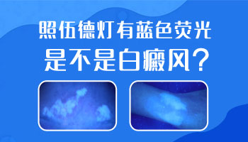 7個月孩子耳朵有一小塊白斑怎么檢查是不是白癜風