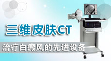 白癜風(fēng)檢測(cè)設(shè)備——三維皮膚CT