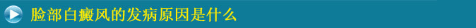 臉部白癜風的發病原因有哪些